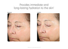 Load image into Gallery viewer, Hyaluronic Acid Boosting Serum
